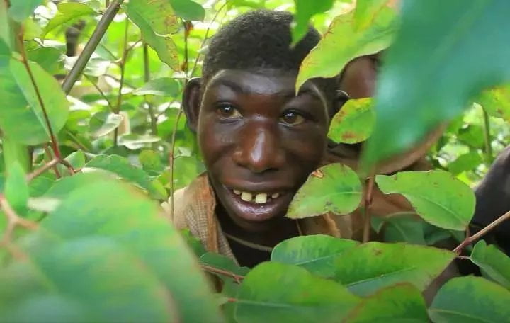 Qui est Zanziman Ellie et qu'est-ce que la microcéphalie? 2