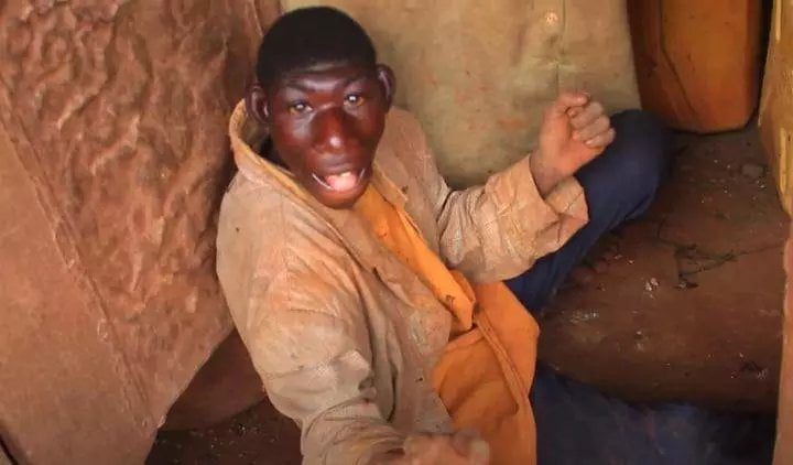 Qui est Zanziman Ellie et qu'est-ce que la microcéphalie? 4