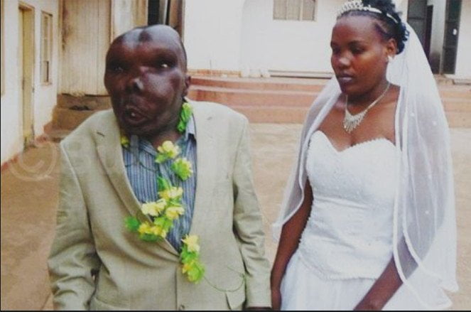 En Ouganda, l’homme le plus laid s'offre une troisième femme 1 En Ouganda, l’homme le plus laid s'offre une troisième femme 1